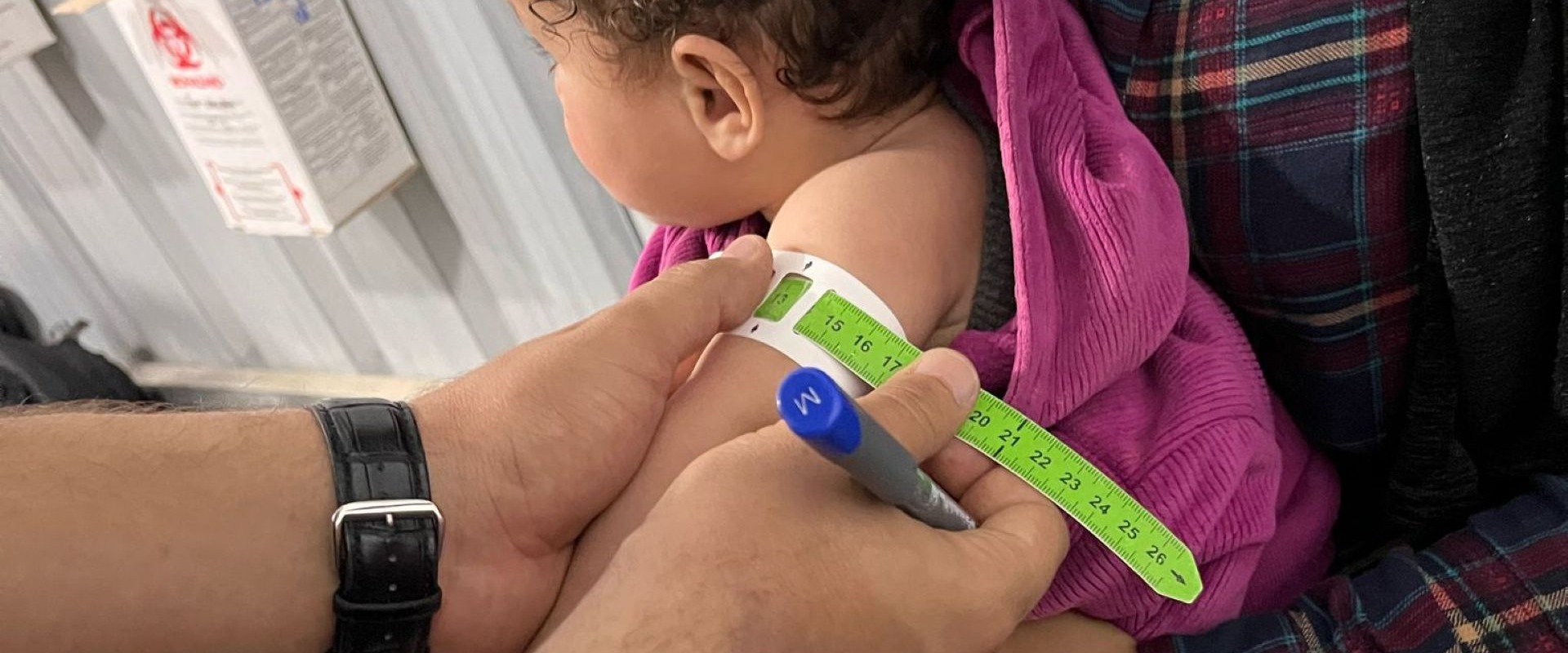 A child is screened for malnutrition in Gaza in April 2025.