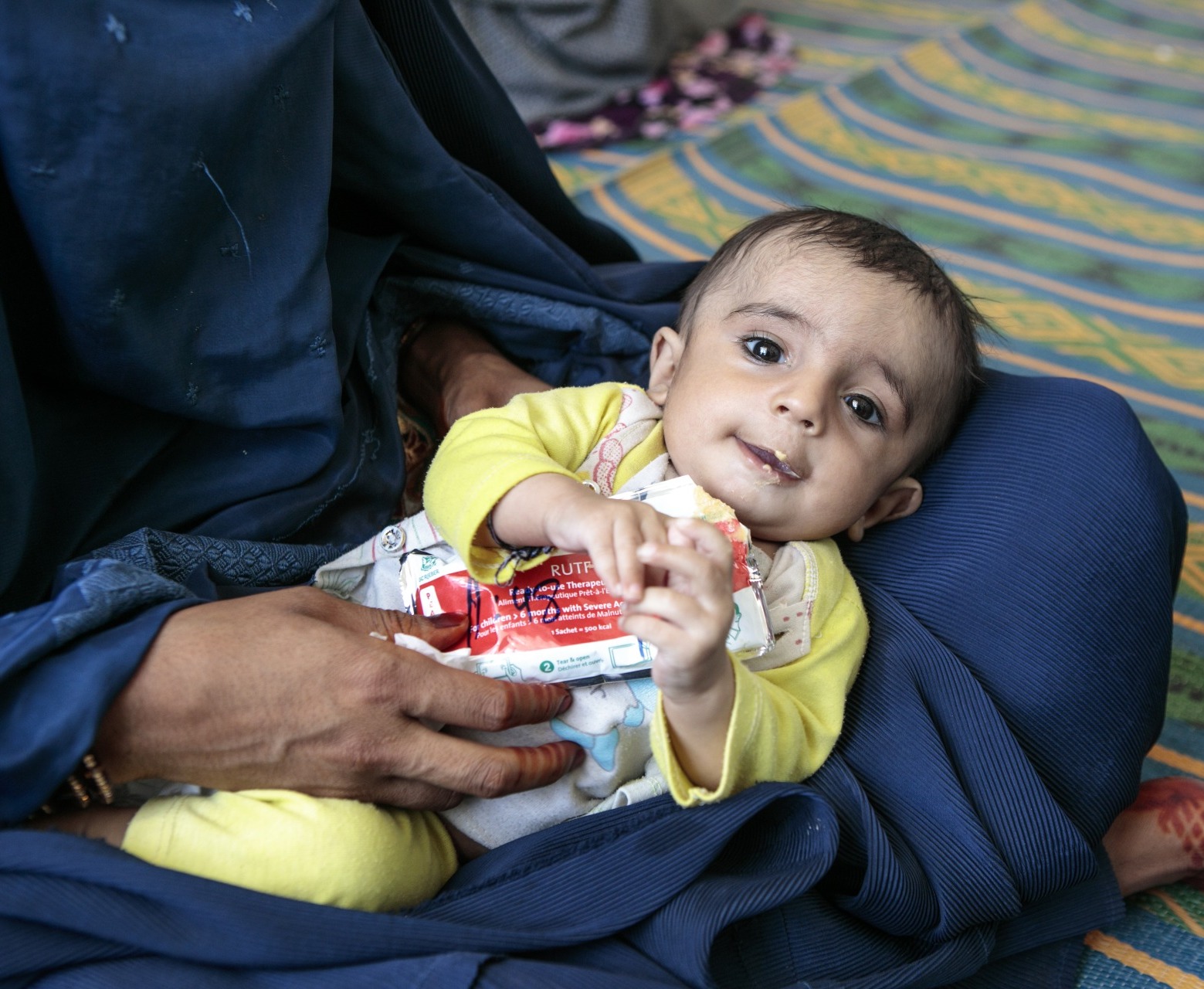 A child eats Plumpy'Nut, a peanut paste used to treat malnutrition.
