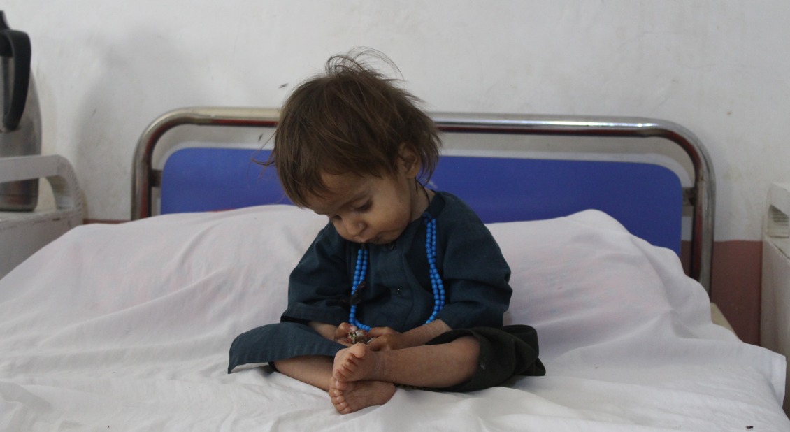 Young boy awaits treatment for malnutrition in Afghanisthan
