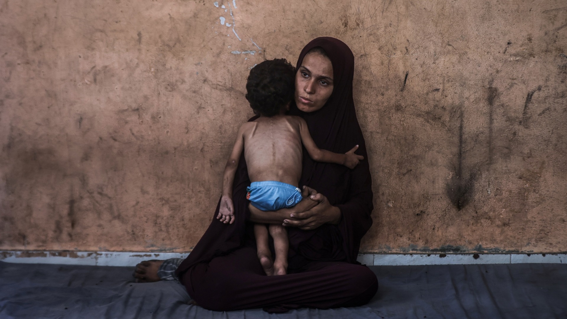 A woman holds a severely malnourished child in Gaza.