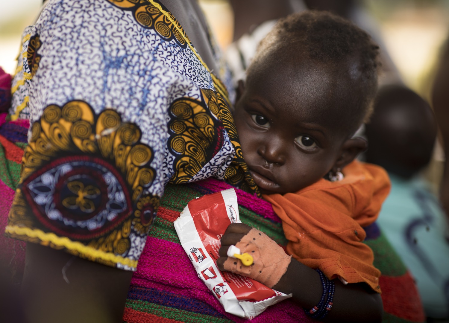 A child, carried by his mother, holds a packet of nutrition treatment