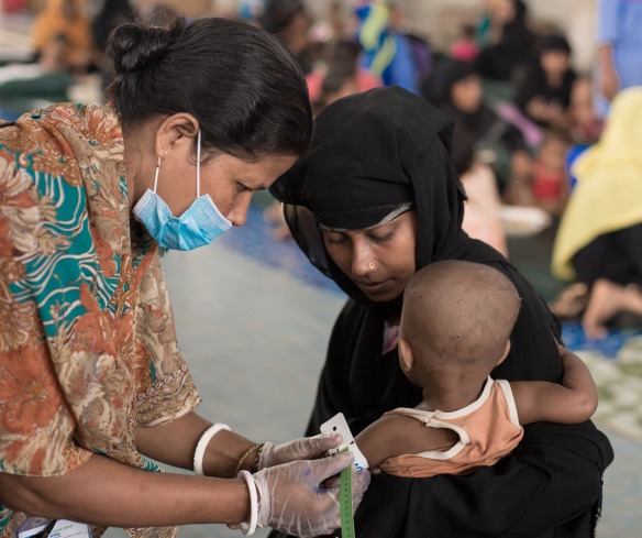A child is measured for malnutrition at one of Action Against Hunger's nutrition centers in Cox's Bazar.
