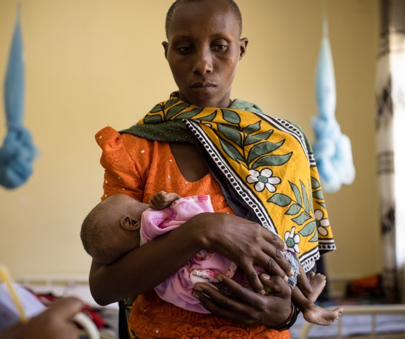 A mother holds her child in a Therapuetic Feeding Unit in Tanzania.